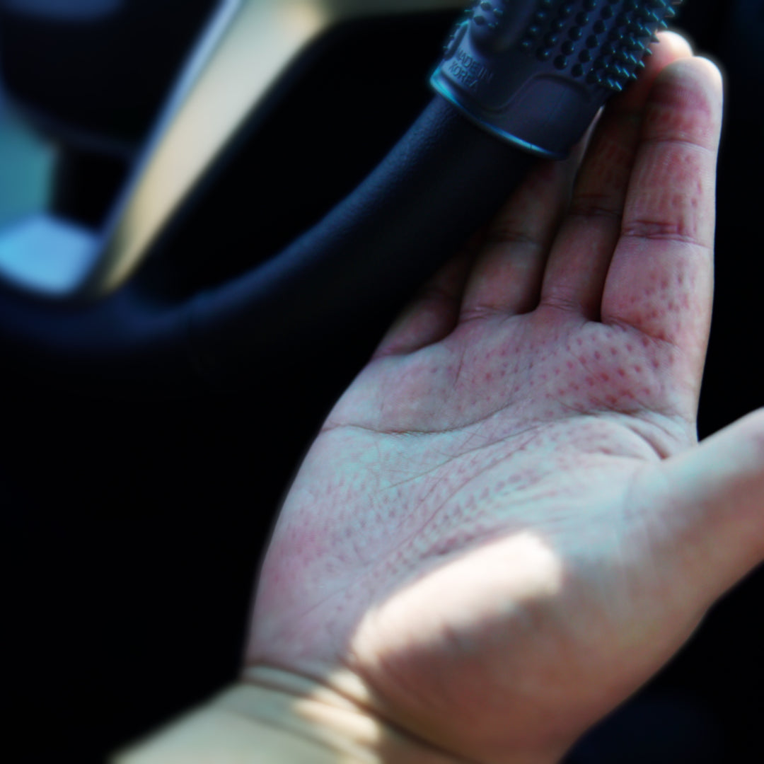 Monster Steer Grip Hand Acupressure Condition